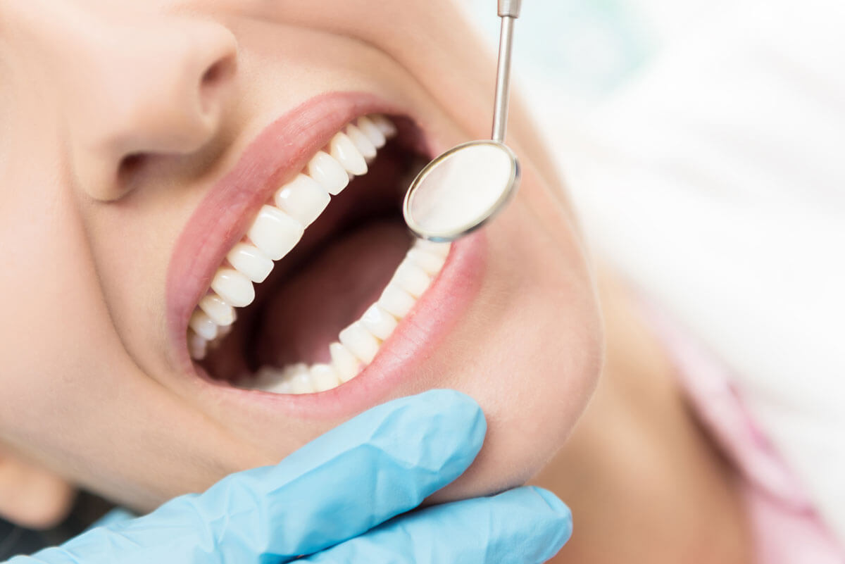 Closeup of Teeth with Dental Mirror